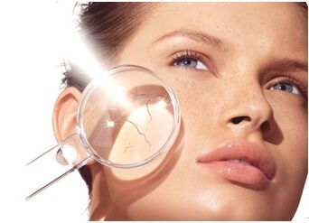 夏季曬傷如何用精油“補救”?芳香世家有方法