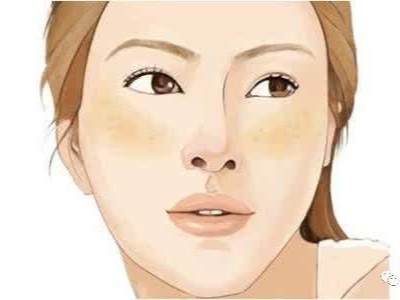 芳香精油淡斑，刻不容緩!