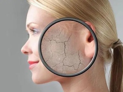 頑固皮膚如何改善?芳香世家有辦法