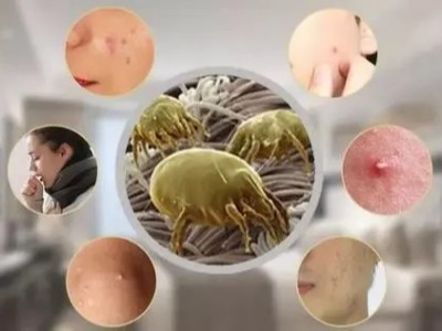 如何使用精油除螨蟲(chóng)?芳香世家來(lái)教你