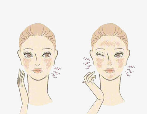 過(guò)敏能使用芳香精油嗎?芳香世家為你解疑答惑