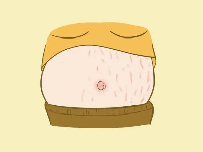 孕期做好這一步,妊娠紋和你說再見